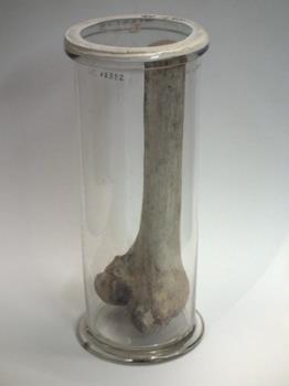 BONE, femur